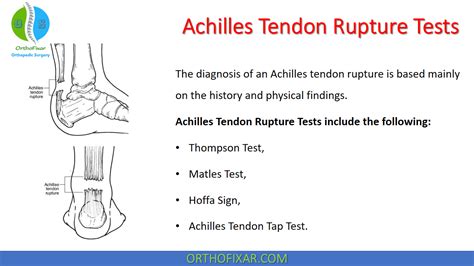 achilles tear special test|achilles heel rupture test.